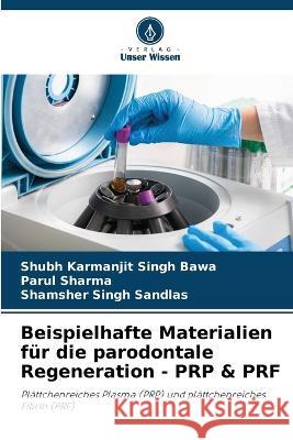 Beispielhafte Materialien für die parodontale Regeneration - PRP & PRF Shubh Karmanjit Singh Bawa, Parul Sharma, Shamsher Singh Sandlas 9786205265536 Verlag Unser Wissen - książka