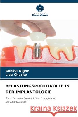 BELASTUNGSPROTOKOLLE IN DER IMPLANTOLOGIE Dighe, Anisha, Chacko, Lisa 9786208974541 Verlag Unser Wissen - książka