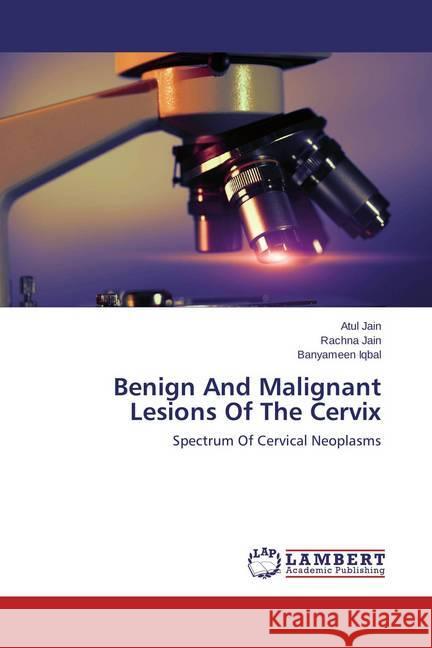 Benign And Malignant Lesions Of The Cervix : Spectrum Of Cervical Neoplasms Jain, Atul; Jain, Rachna; Iqbal, Banyameen 9783659531347 LAP Lambert Academic Publishing - książka