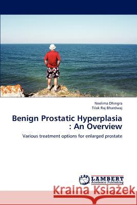 Benign Prostatic Hyperplasia: An Overview Dhingra, Neelima 9783659191039 LAP Lambert Academic Publishing - książka