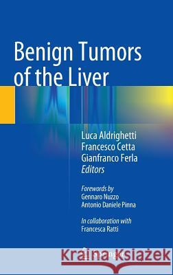 Benign Tumors of the Liver Luca Aldrighetti Francesco Cetta Cetta Gianfranco Ferla 9783319129846 Springer - książka