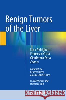 Benign Tumors of the Liver Luca Aldrighetti Francesco Cetta Gianfranco Ferla 9783319346731 Springer - książka