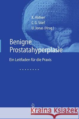 Benigne Prostatahyperplasie: Leitfaden Für Die Praxis Höfner, K. 9783642640346 Springer - książka