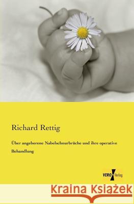 Über angeborene Nabelschnurbrüche und ihre operative Behandlung Richard Rettig 9783957385901 Vero Verlag - książka