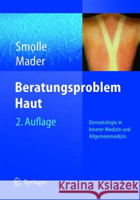 Beratungsproblem Haut: Dermatologie in Innerer Medizin und Allgemeinmedizin Smolle, Josef 9783540211853 Springer - książka