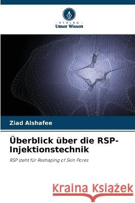 ?berblick ?ber die RSP-Injektionstechnik Ziad Alshafee 9786205629079 Verlag Unser Wissen - książka