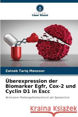 Überexpression der Biomarker Egfr, Cox-2 und Cyclin D1 in Escc Zainab Tariq Manzoor 9786205370063 Verlag Unser Wissen - książka