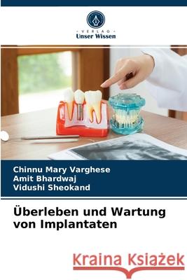 Überleben und Wartung von Implantaten Chinnu Mary Varghese, Amit Bhardwaj, Vidushi Sheokand 9786204067506 Verlag Unser Wissen - książka