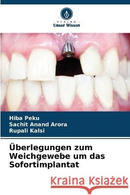 Überlegungen zum Weichgewebe um das Sofortimplantat Peku, Hiba 9786205321720 Verlag Unser Wissen - książka