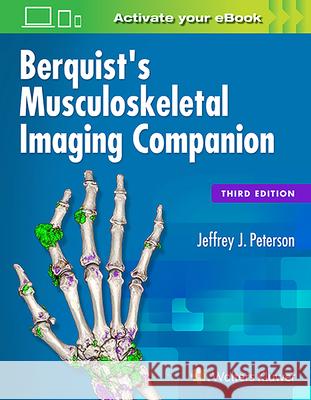 Berquist's Musculoskeletal Imaging Companion Jeffrey J. Peterson 9781496314994 LWW - książka