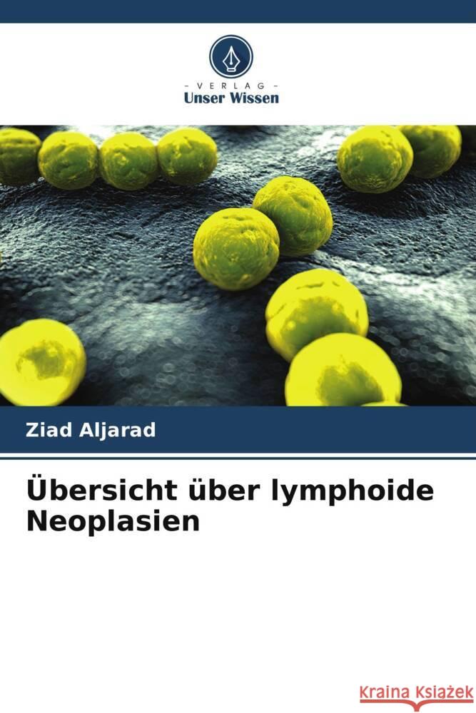 Übersicht über lymphoide Neoplasien Aljarad, Ziad 9786208182052 Verlag Unser Wissen - książka