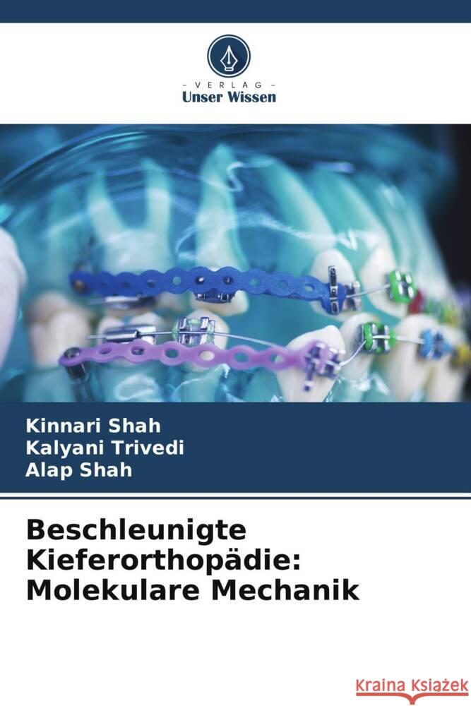 Beschleunigte Kieferorthopadie: Molekulare Mechanik Kinnari Shah Kalyani Trivedi Alap Shah 9786206007654 Verlag Unser Wissen - książka