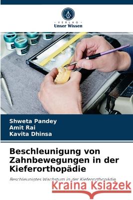 Beschleunigung von Zahnbewegungen in der Kieferorthopädie Shweta Pandey, Amit Rai, Kavita Dhinsa 9786204061870 Verlag Unser Wissen - książka