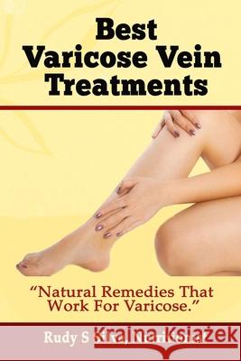 Best Varicose Vein Treatments: Natural Remedies That Work for Varicose Rudy Silva Silva 9781492778479 Createspace - książka