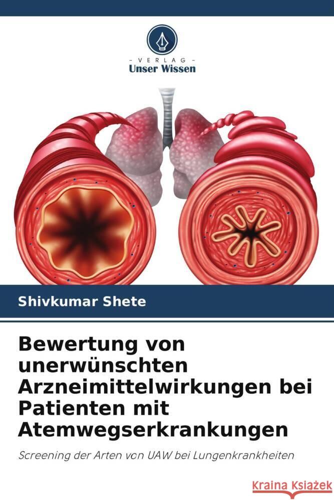 Bewertung von unerwünschten Arzneimittelwirkungen bei Patienten mit Atemwegserkrankungen Shete, Shivkumar 9786205428481 Verlag Unser Wissen - książka