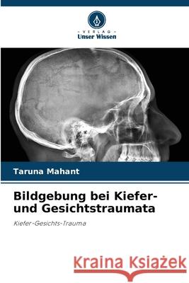 Bildgebung bei Kiefer- und Gesichtstraumata Mahant, Taruna 9786209264092 Verlag Unser Wissen - książka