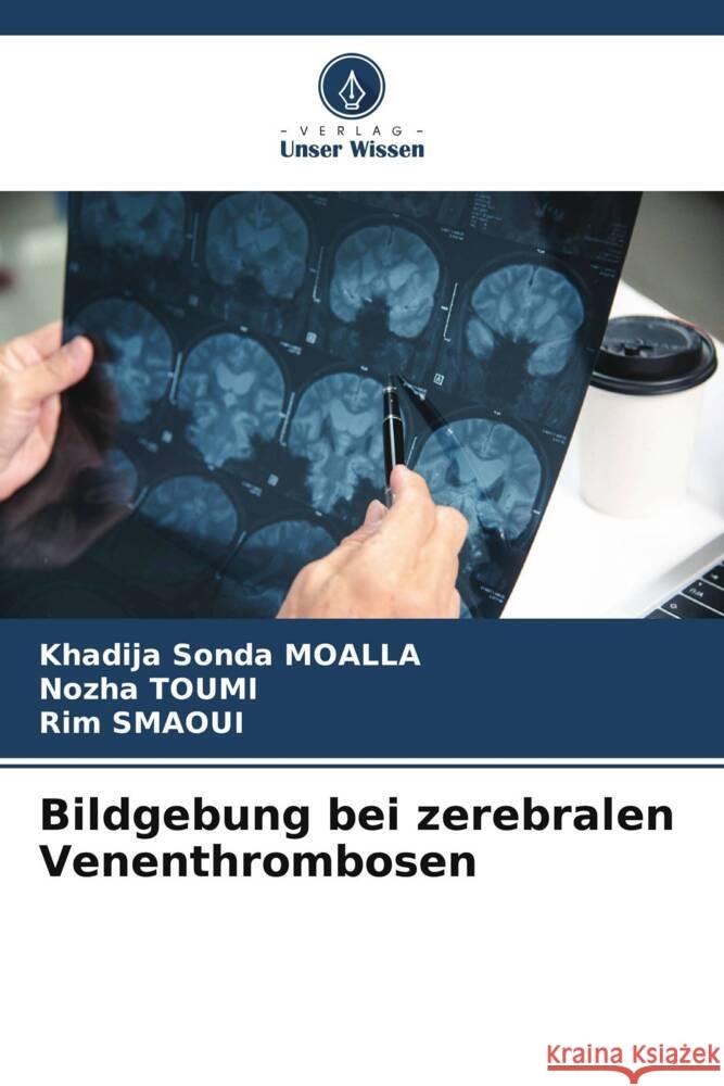 Bildgebung bei zerebralen Venenthrombosen MOALLA, Khadija Sonda, Toumi, Nozha, SMAOUI, Rim 9786208531577 Verlag Unser Wissen - książka