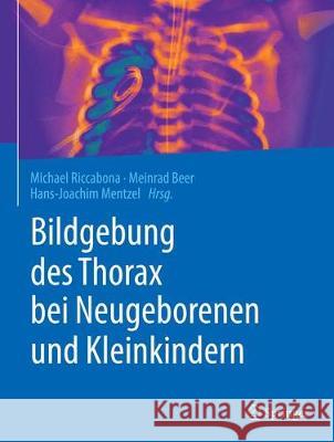 Bildgebung Des Thorax Bei Neugeborenen Und Kleinkindern Riccabona, Michael 9783662578131 Springer, Berlin - książka