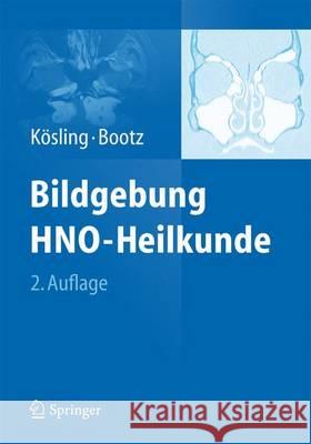 Bildgebung Hno-Heilkunde Kösling, Sabrina 9783642451324 Springer - książka