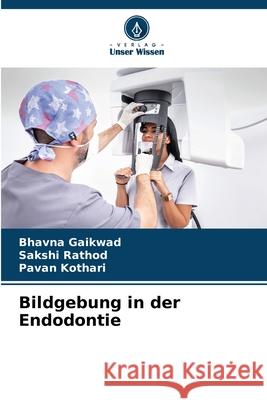 Bildgebung in der Endodontie Gaikwad, Bhavna, Rathod, Sakshi, Kothari, Pavan 9786209393051 Verlag Unser Wissen - książka