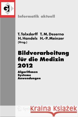 Bildverarbeitung Für Die Medizin 2012: Algorithmen - Systeme - Anwendungen. Proceedings Des Workshops Vom 18. Bis 20. März 2012 in Berlin Tolxdorff, Thomas 9783642285011 Springer, Berlin - książka