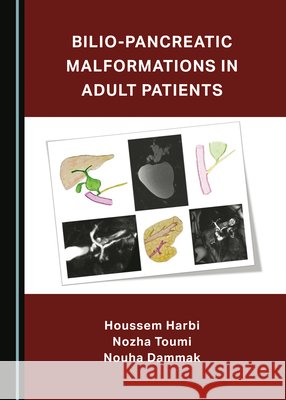 Bilio-Pancreatic Malformations in Adult Patients Houssem Harbi, Nozha Toumi, Nouha Dammak 9781527525405 Cambridge Scholars Publishing - książka