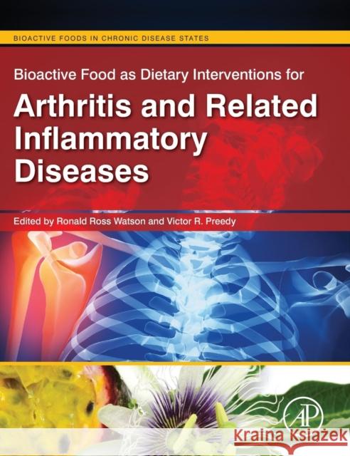 Bioactive Food as Interventions for Arthritis and Related Inflammatory Diseases Watson, Ronald Ross 9780123971562 ACADEMIC PRESS - książka