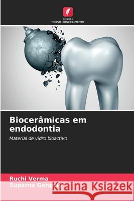 Biocerâmicas em endodontia Ruchi Verma, Suparna Ganguly 9786204134567 Edicoes Nosso Conhecimento - książka