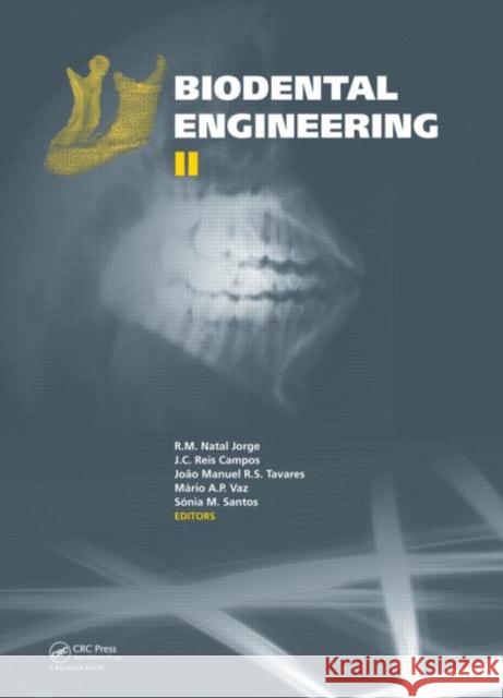 Biodental Engineering II  9781138001312 CRC Press - książka