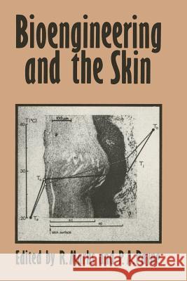 Bioengineering and the Skin: Based on the Proceedings of the European Society for Dermatological Research Symposium, Held at the Welsh National Sch Marks, R. 9789400973121 Springer - książka