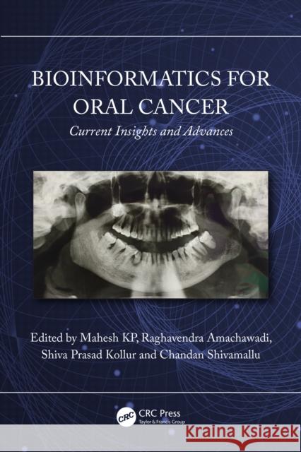 Bioinformatics for Oral Cancer  9781032625706 Taylor & Francis Ltd - książka