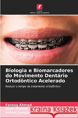 Biologia e Biomarcadores do Movimento Dent?rio Ortod?ntico Acelerado Farooq Ahmad Stuti Mohan Achint Juneja 9786205706633 Edicoes Nosso Conhecimento - książka