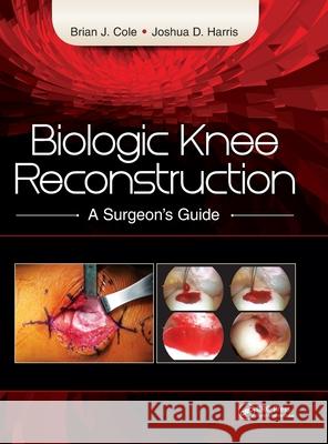Biologic Knee Reconstruction: A Surgeon's Guide Cole, Brian 9781617118166 Slack - książka