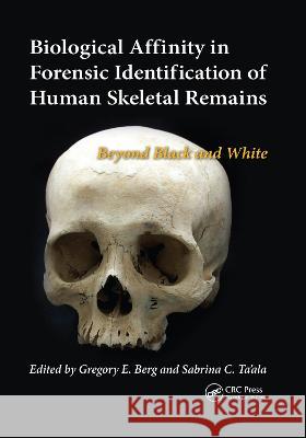Biological Affinity in Forensic Identification of Human Skeletal Remains: Beyond Black and White Berg, Gregory E. 9780367778460 Taylor and Francis - książka