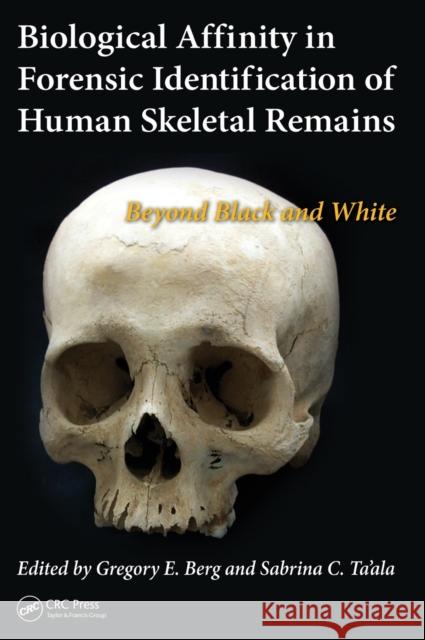 Biological Affinity in Forensic Identification of Human Skeletal Remains: Beyond Black and White Gregory E. Berg Sabrina C. Ta'ala 9781439815755 CRC Press - książka