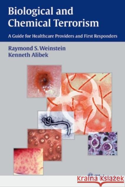 Biological and Chemical Terrorism: A Guide for Healthcare Providers and First Responders Weinstein, Raymond S. 9781588901866 Thieme Medical Publishers - książka