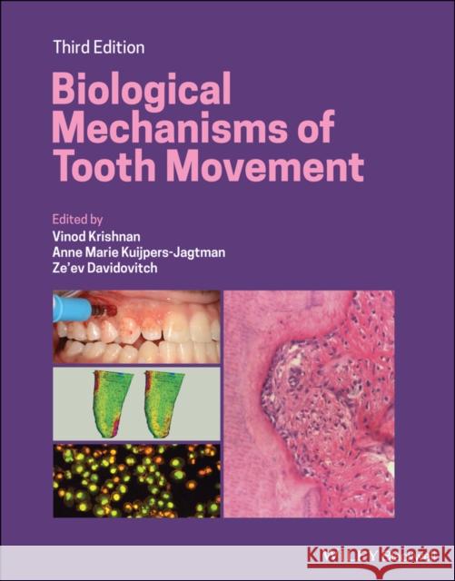 Biological Mechanisms of Tooth Movement Vinod Krishnan Anne Marie Kuijpers-Jagtman Ze'ev Davidovitch 9781119608936 Wiley-Blackwell - książka