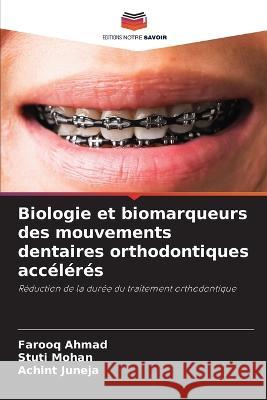 Biologie et biomarqueurs des mouvements dentaires orthodontiques acc?l?r?s Farooq Ahmad Stuti Mohan Achint Juneja 9786205706688 Editions Notre Savoir - książka