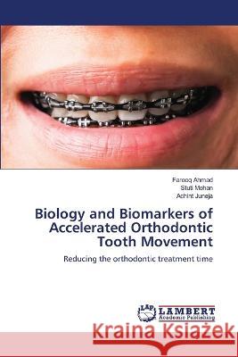 Biology and Biomarkers of Accelerated Orthodontic Tooth Movement Farooq Ahmad Stuti Mohan Achint Juneja 9786205633519 LAP Lambert Academic Publishing - książka