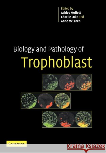 Biology and Pathology of Trophoblast Ashley Moffett Charlie Loke Anne McLaren 9781107403154 Cambridge University Press - książka