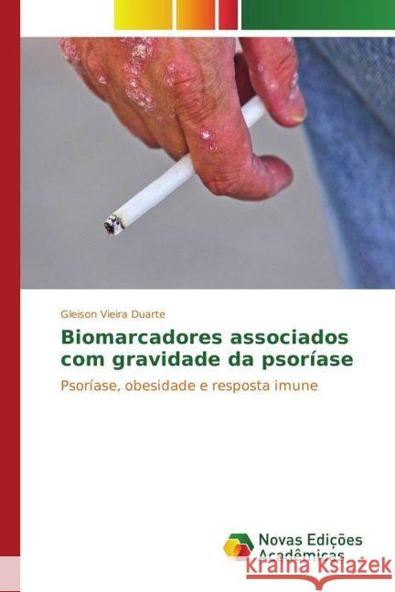 Biomarcadores associados com gravidade da psoríase : Psoríase, obesidade e resposta imune Vieira Duarte, Gleison 9783330775787 Novas Edicioes Academicas - książka