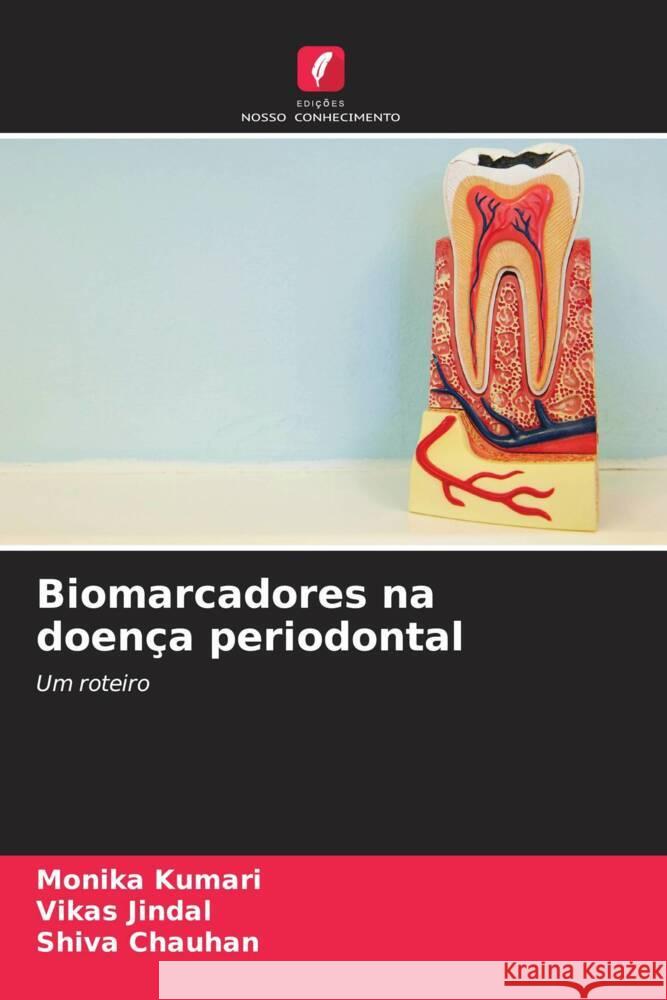 Biomarcadores na doença periodontal Kumari, Monika, Jindal, Vikas, Chauhan, Shiva 9786204609959 Edições Nosso Conhecimento - książka