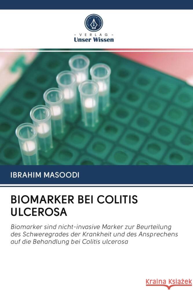 BIOMARKER BEI COLITIS ULCEROSA Masoodi, Ibrahim 9786202779500 Verlag Unser Wissen - książka