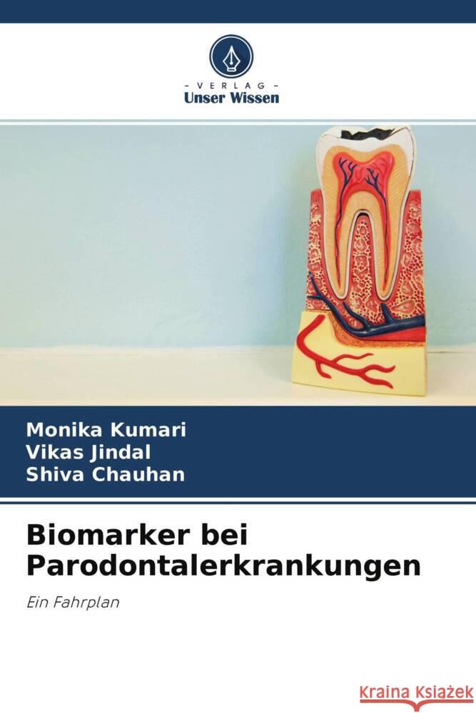 Biomarker bei Parodontalerkrankungen Kumari, Monika, Jindal, Vikas, Chauhan, Shiva 9786204609966 Verlag Unser Wissen - książka