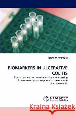 Biomarkers in Ulcerative Colitis  9783844303759 LAP Lambert Academic Publishing AG & Co KG - książka