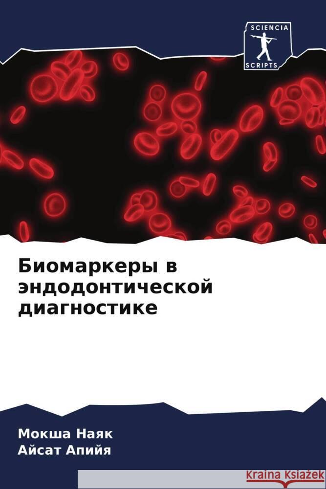 Biomarkery w ändodonticheskoj diagnostike Naqk, Moksha, Apijq, Ajsat 9786204659589 Sciencia Scripts - książka