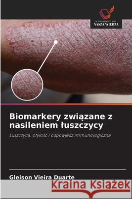 Biomarkery zwiazane z nasileniem luszczycy Vieira Duarte, Gleison 9786208668297 Wydawnictwo Nasza Wiedza - książka