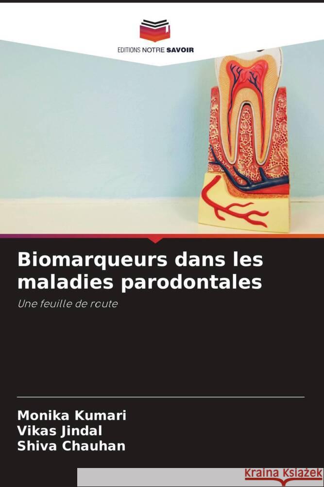 Biomarqueurs dans les maladies parodontales Kumari, Monika, Jindal, Vikas, Chauhan, Shiva 9786204609980 Editions Notre Savoir - książka