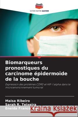 Biomarqueurs pronostiques du carcinome épidermoïde de la bouche Ribeiro, Maisa, R. Teixeira, Sarah, Franco Vêncio, Eneida 9786208774813 Editions Notre Savoir - książka