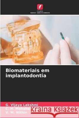 Biomateriais em implantodontia G. Vijay C. H. Mahabaleshwara V. M. Nithin 9786205748138 Edicoes Nosso Conhecimento - książka